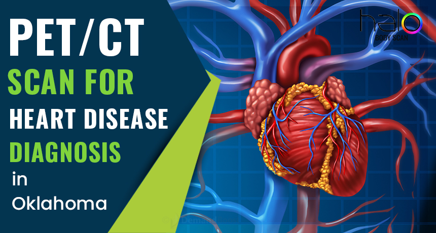 PET/CT Scans for Heart Disease Diagnosis in Oklahoma