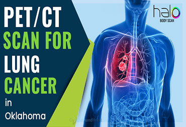 PET/CT Scan of lungs in Oklahoma